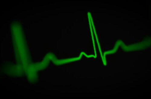 ekg måling