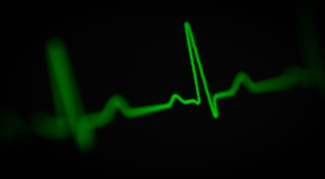ekg måling